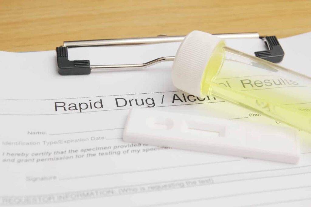 Photo of drug test kits illustrating how long THC stays in your system