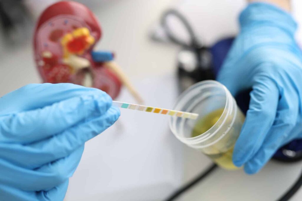 A medical professional conducting a urine test to detect fentanyl